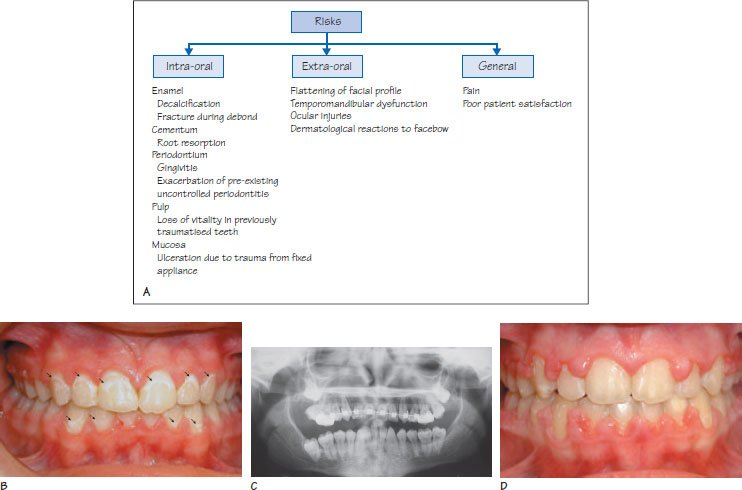 orthodonti