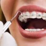 What do you think about orthodonti?