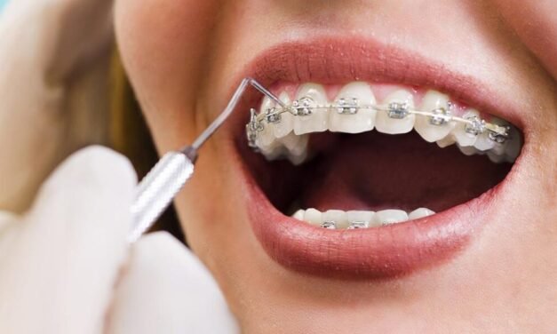 What do you think about orthodonti?