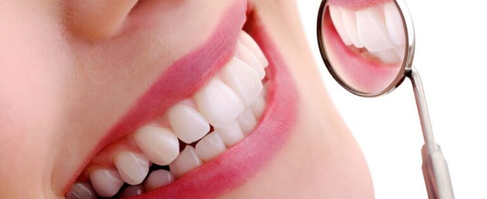 full mouth restoration what patients should expect