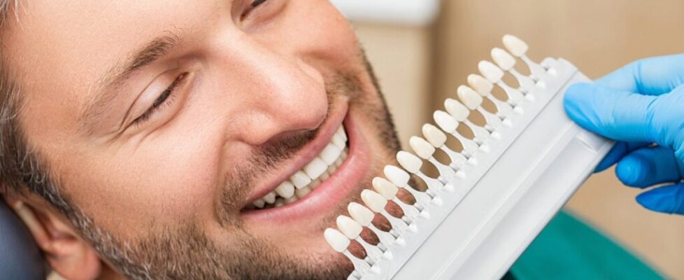 can-veneers-fix-gaps-or-crooked-teeth